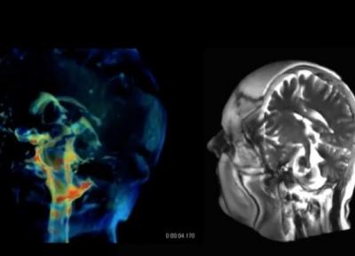 فناوری جدید برای تصویربرداری 3 بعدی از مغز